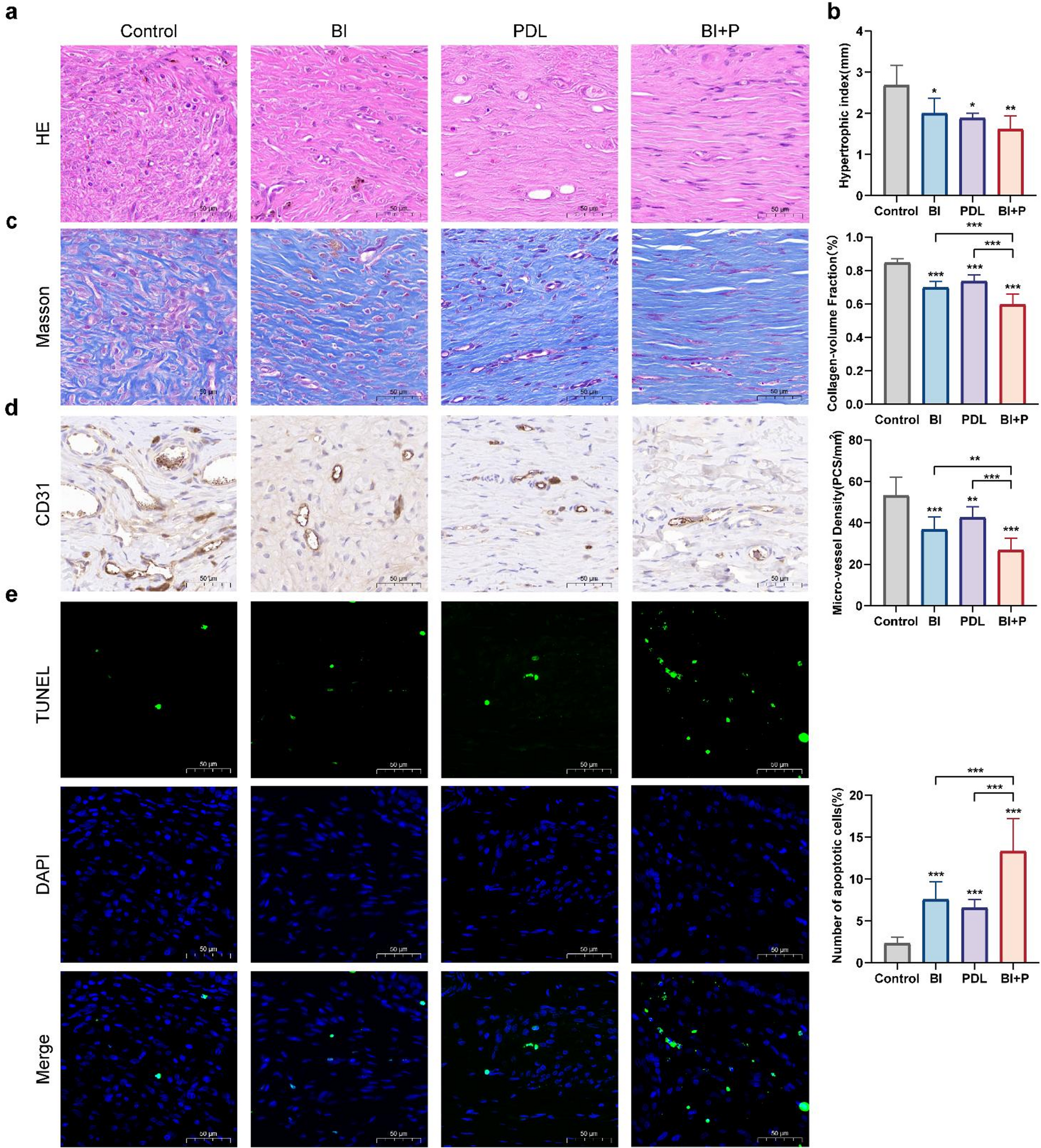 Combined compound betamethasone and 595 nm pulsed dye laser improves hypertrophic scar and is associated with enhanced autophagy in myofibroblasts