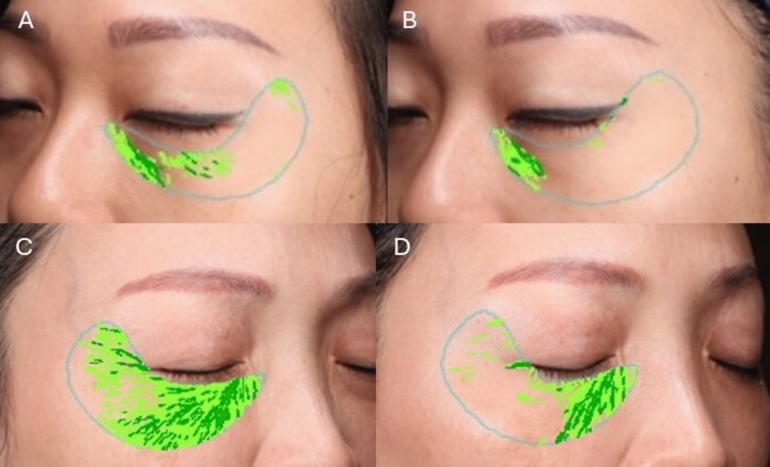 Fig. 4