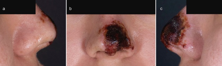FIGURE 1