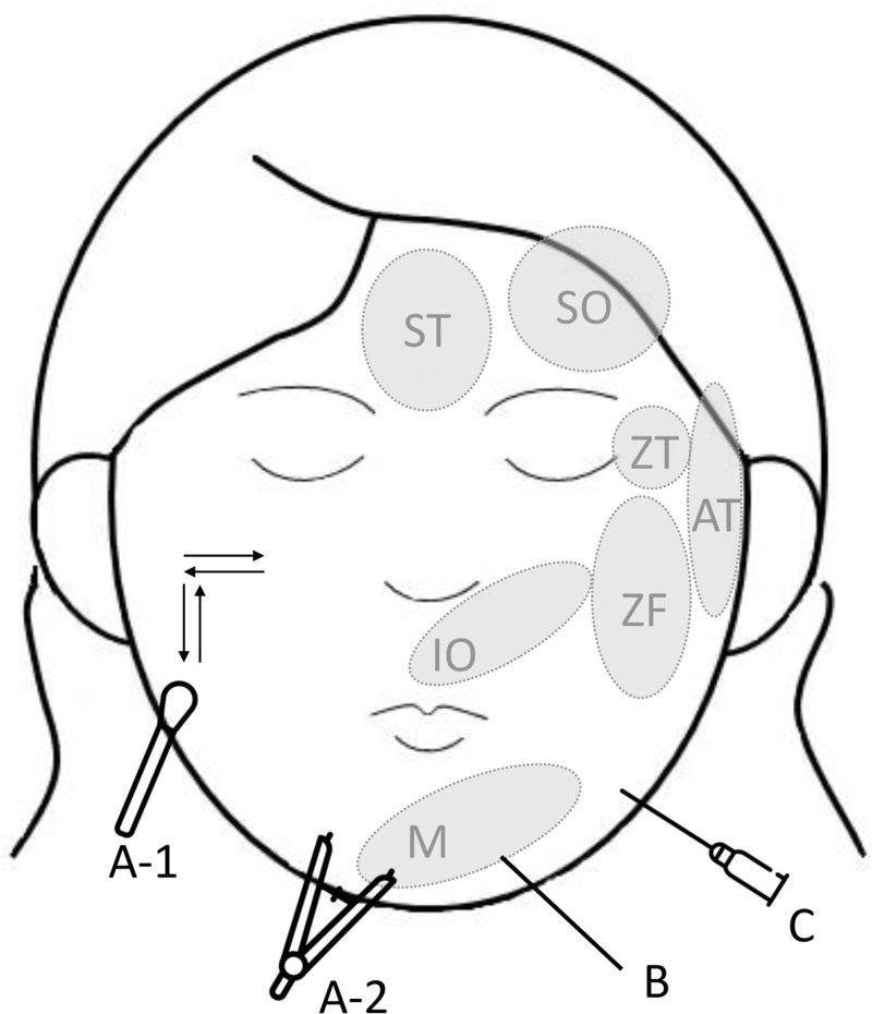 Fig. 2.