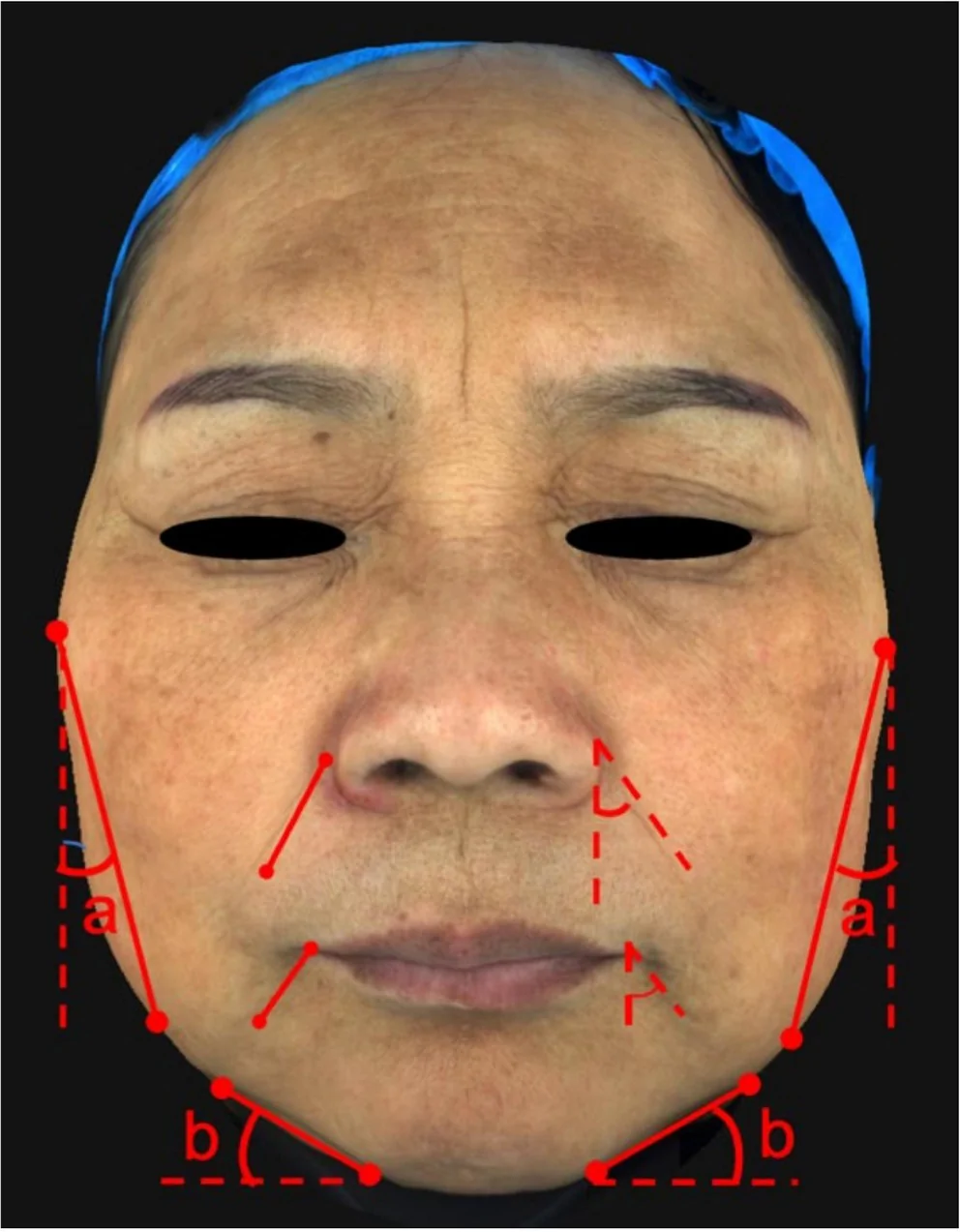 FIGURE 3
