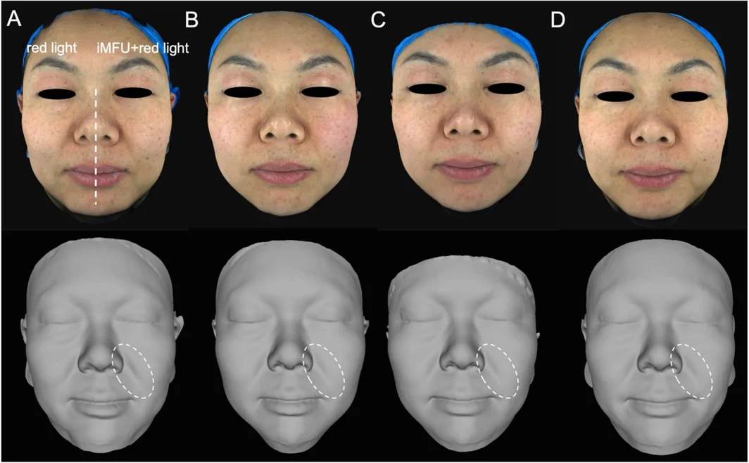 FIGURE 4