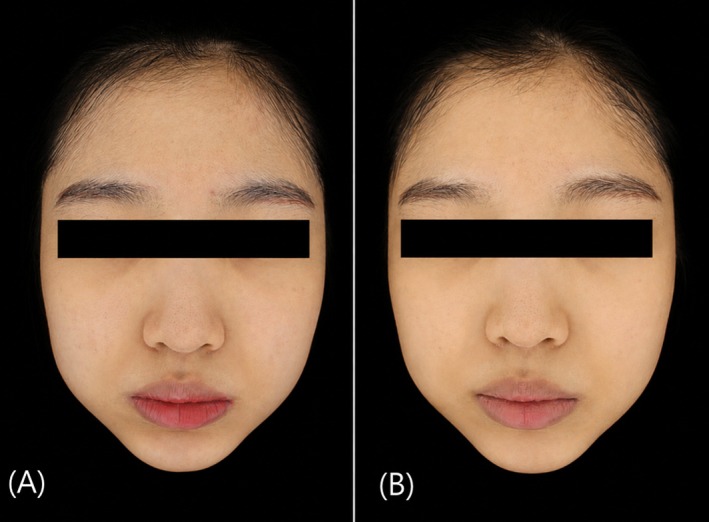 FIGURE 3