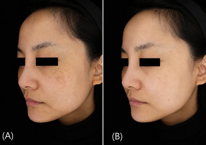FIGURE 4