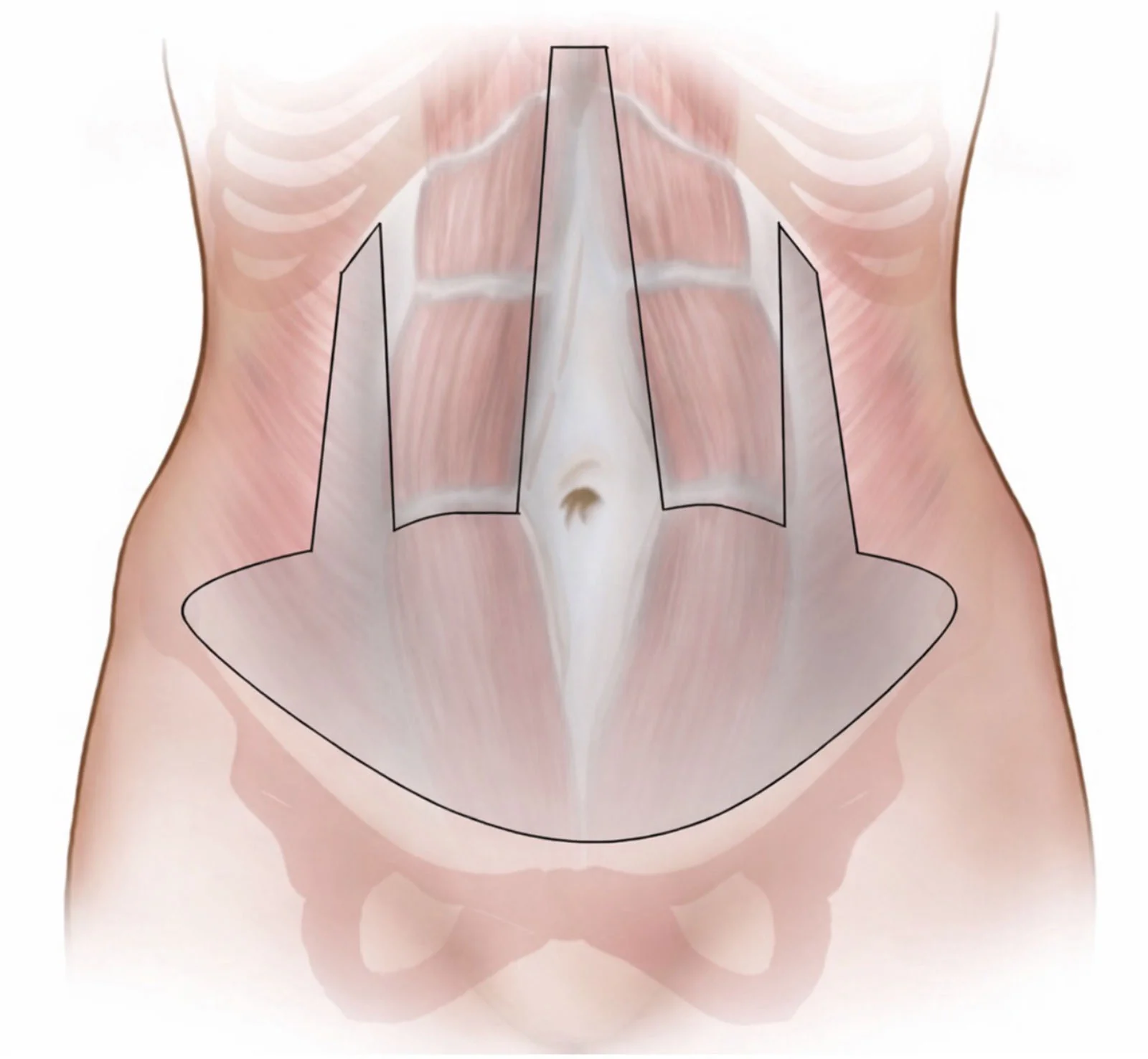 Fig. 2.