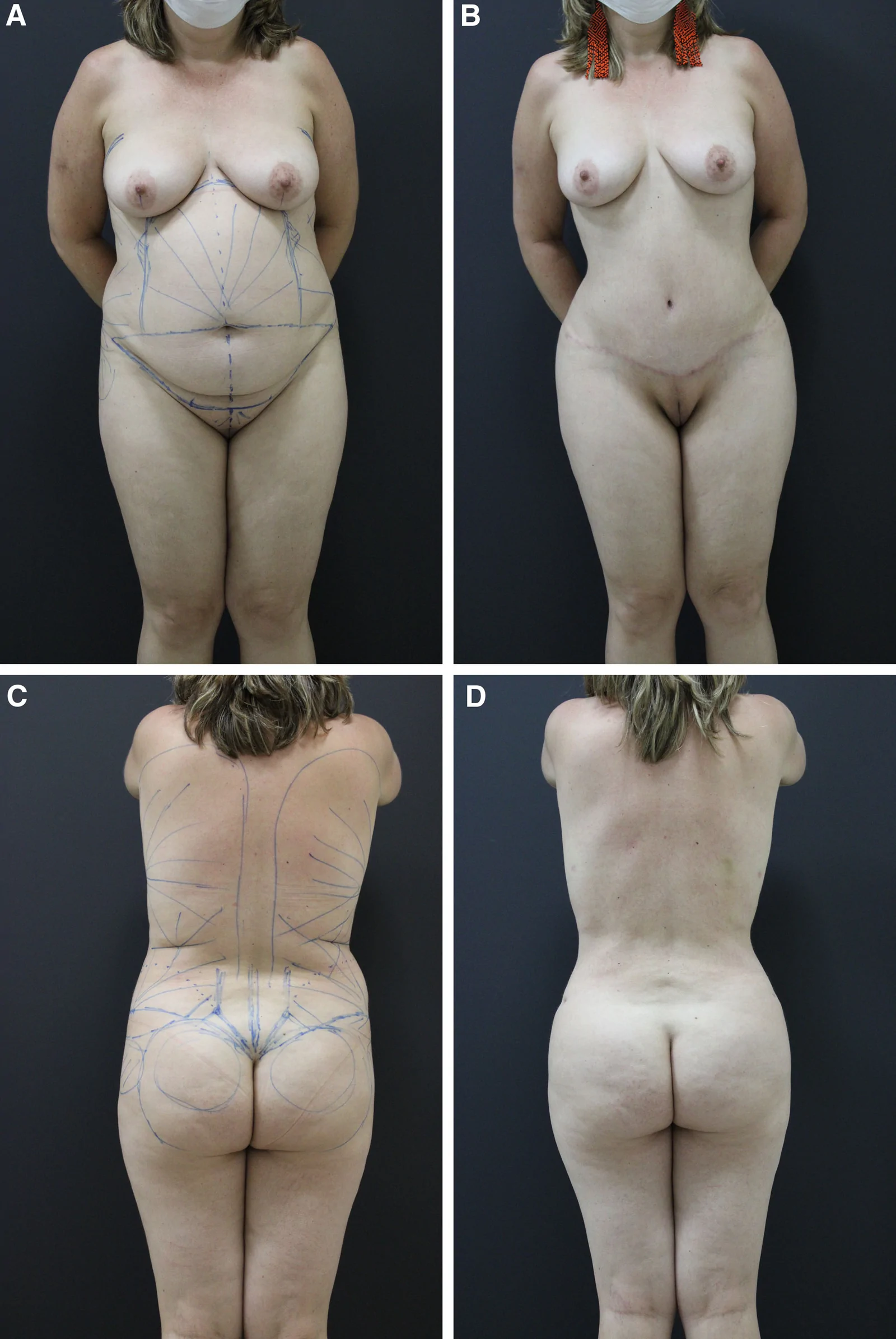 Fig. 4.