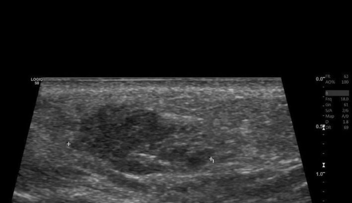 FIGURE 3