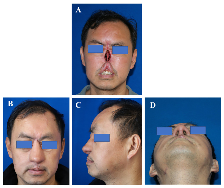 Figure 6