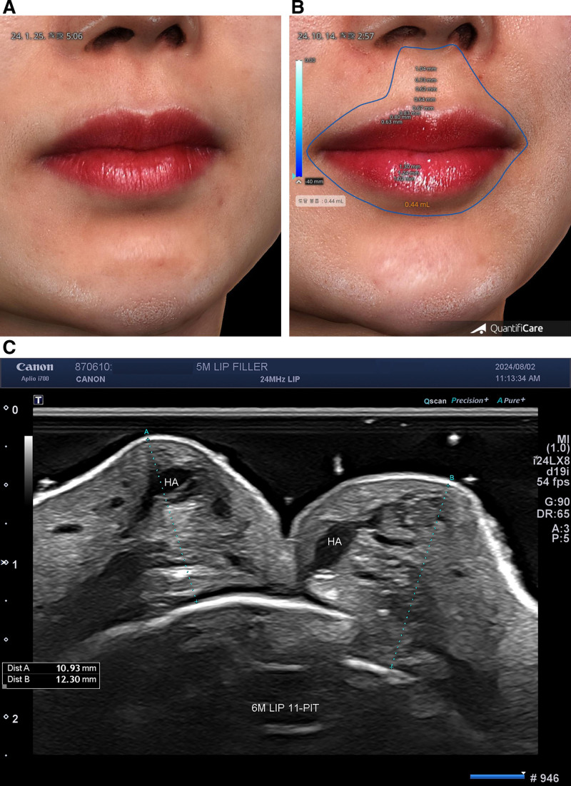 Fig. 10.
