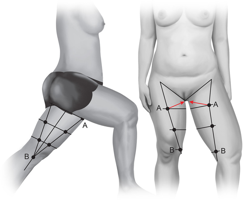 Fig. 11.