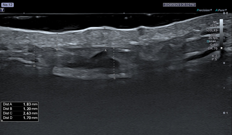 Fig. 12.