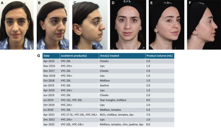 FIGURE 3