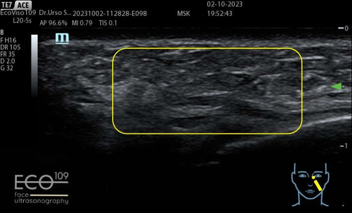 FIGURE 15