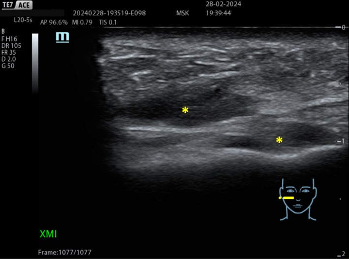 FIGURE 11