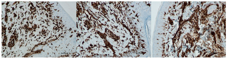 Figure 22