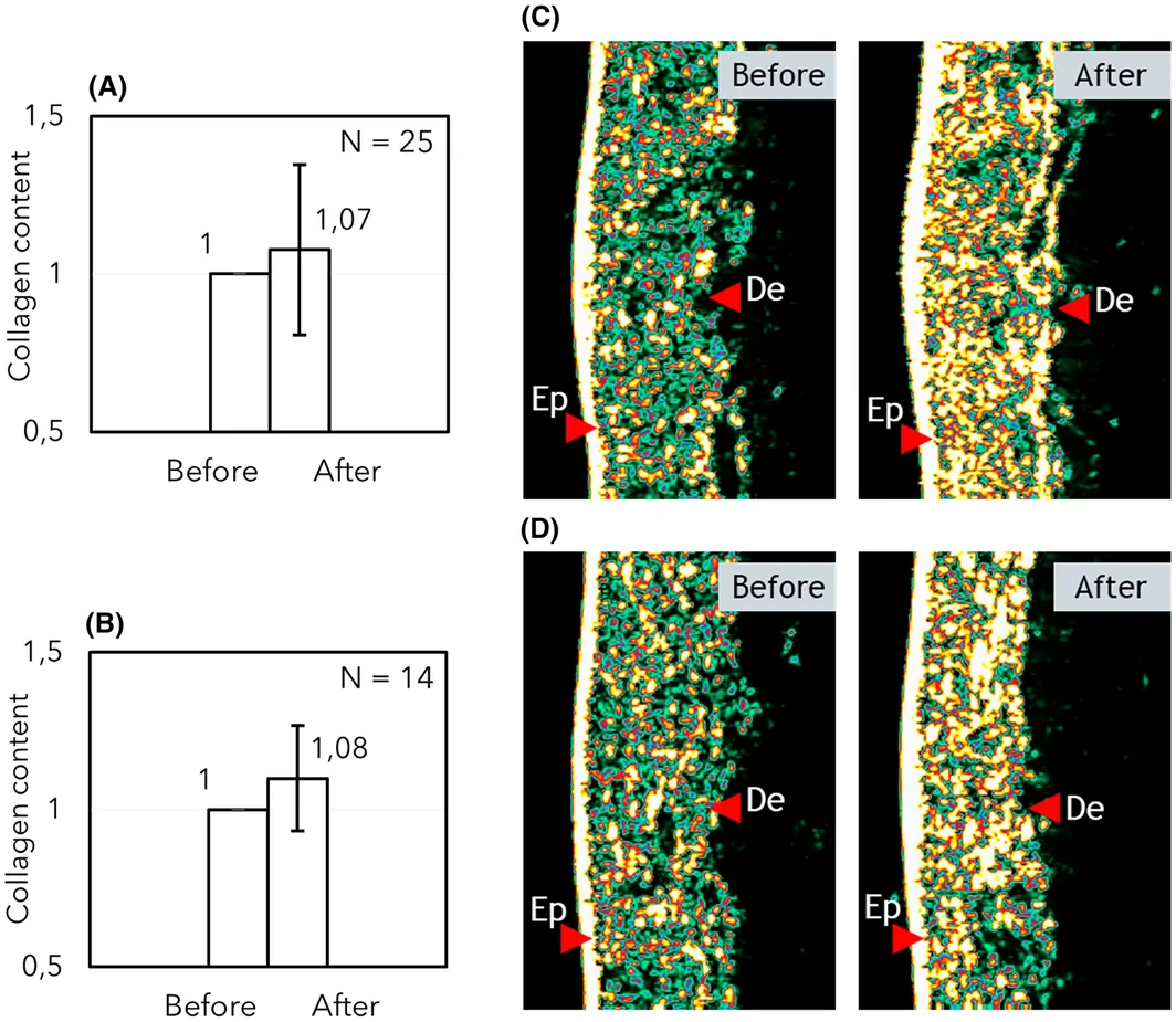 FIGURE 4