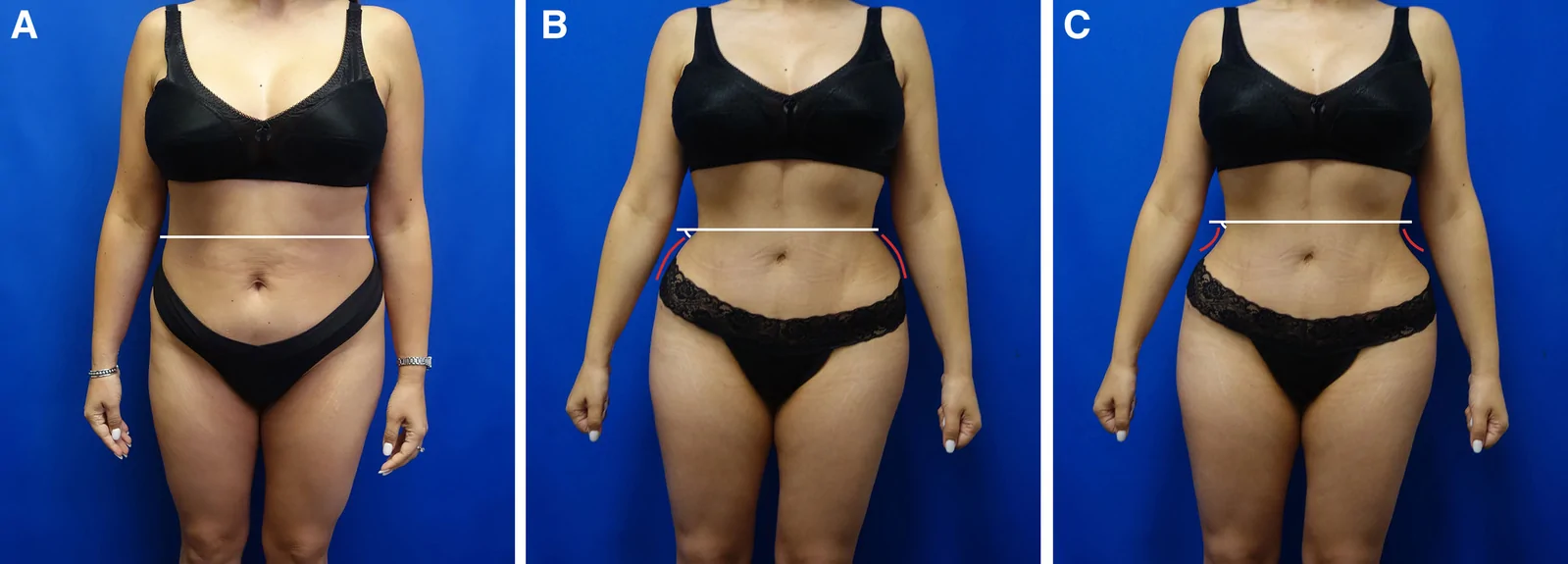 Fig. 7.
