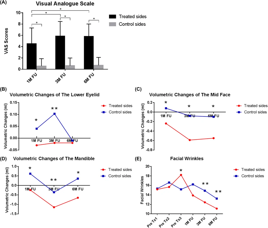 FIGURE 3