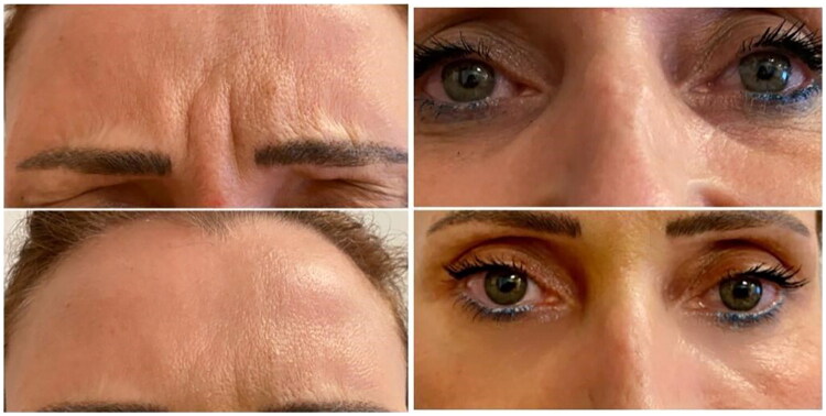 Figure 3 - Before and After